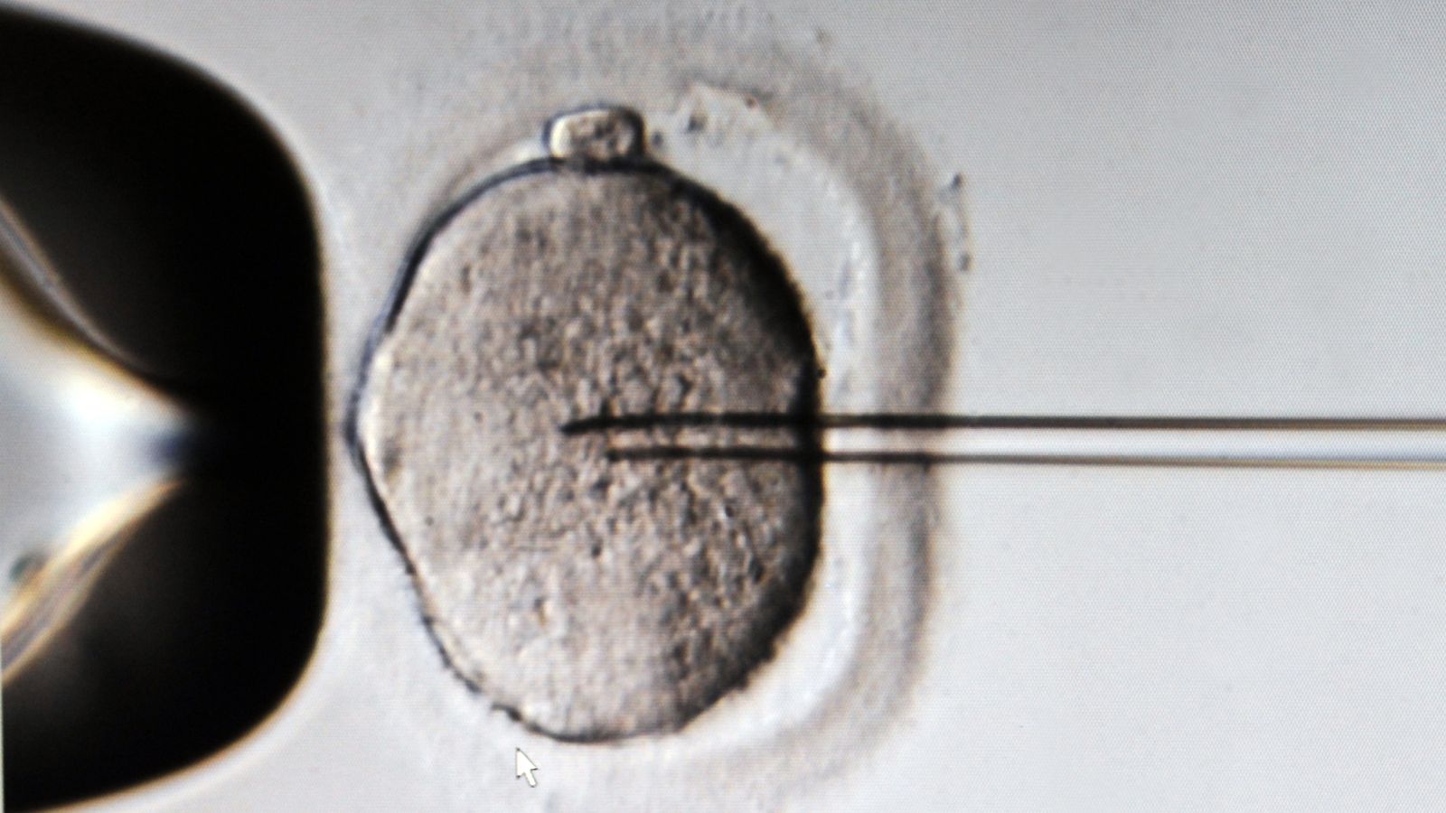 IVF: More than 100 patients at Guy’s and St Thomas’ and Jessop Fertility ‘exposed to faulty egg and embryo freezing liquid’ | UK News